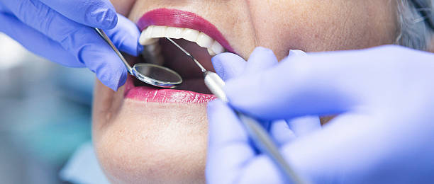 Best Knocked-Out Tooth (Avulsed Tooth) Treatment in Telford, PA